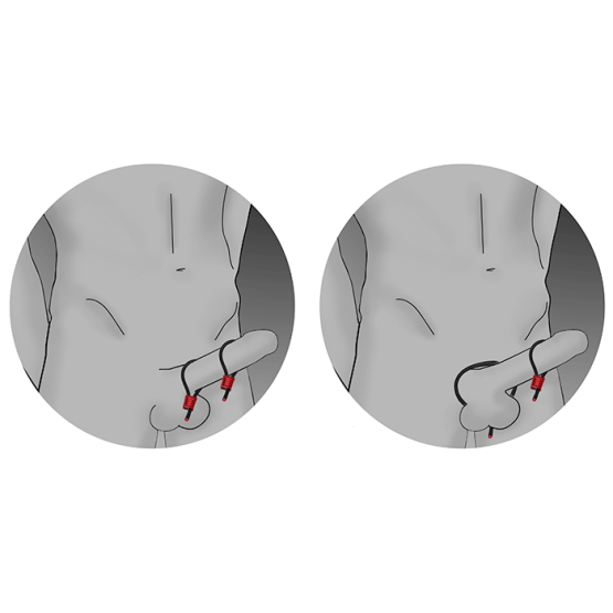 ElectraStim x Mr S Leather Prestige ElectraLoops